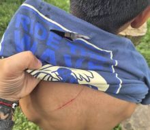 Violencia en una escuela de Salto: niña cortó la espalda de un compañero con una trincheta